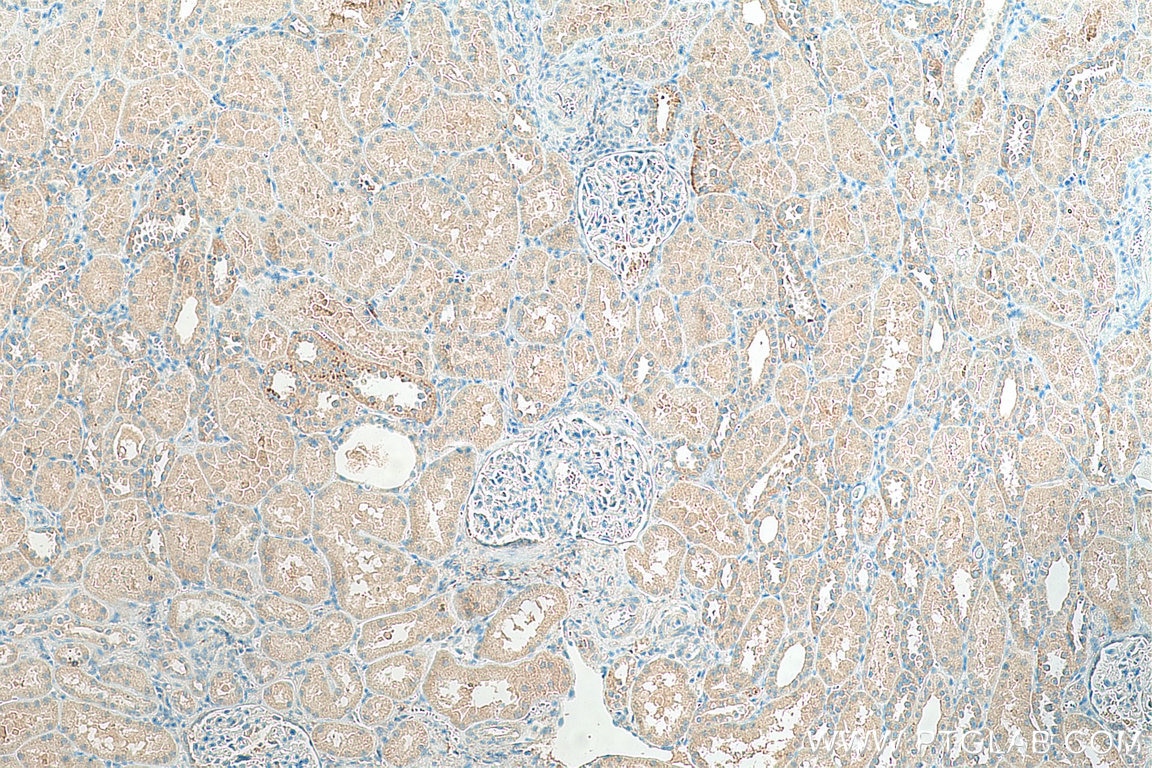 Immunohistochemistry (IHC) staining of human kidney tissue using SLC43A1 Polyclonal antibody (10444-1-AP)