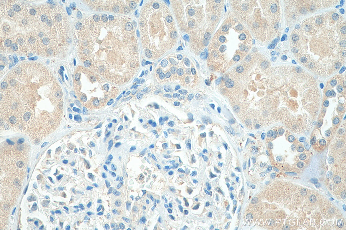 Immunohistochemistry (IHC) staining of human kidney tissue using SLC43A1 Polyclonal antibody (10444-1-AP)