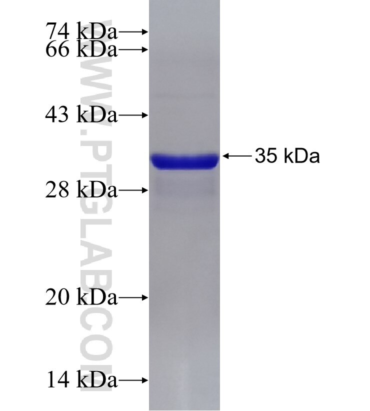 SLC43A1 fusion protein Ag31817 SDS-PAGE