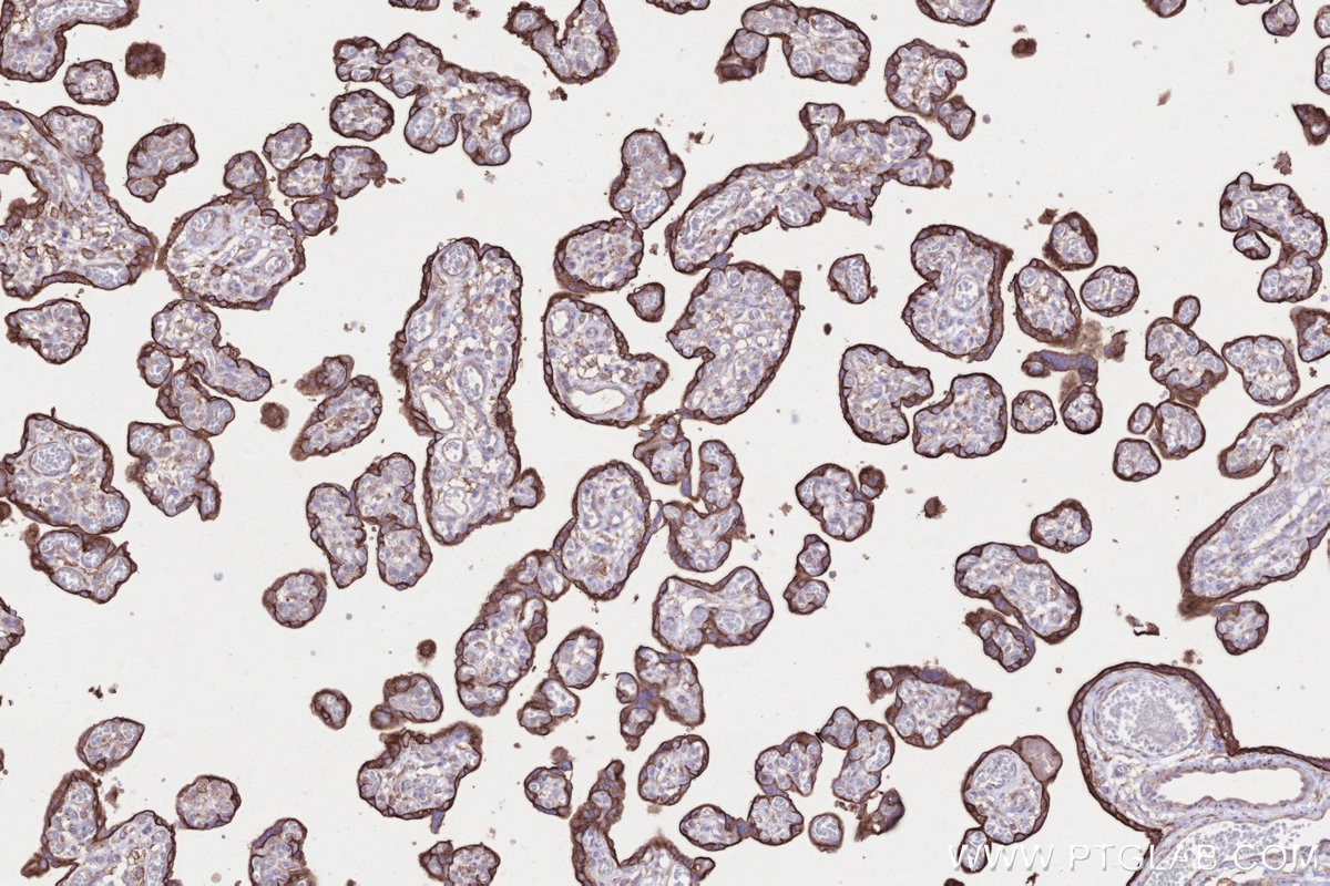 Immunohistochemistry (IHC) staining of human placenta tissue using SLC43A2 Polyclonal antibody (30031-1-AP)