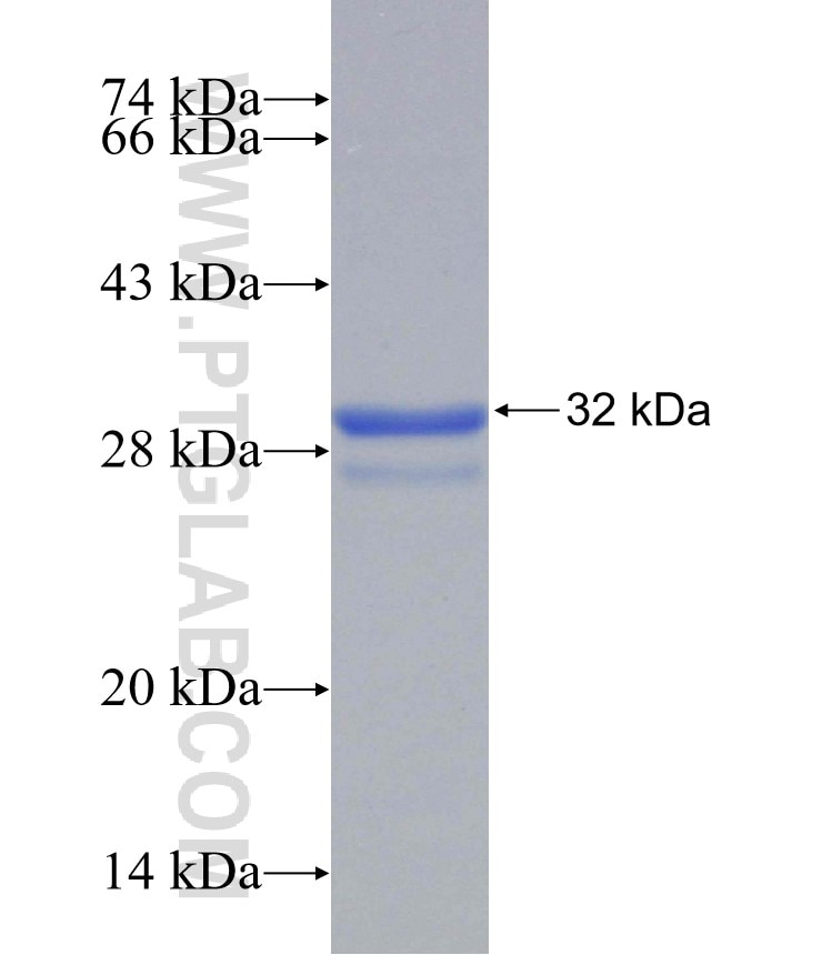 SLC43A2 fusion protein Ag31341 SDS-PAGE