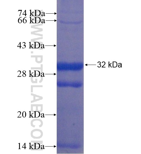 SLC44A2 fusion protein Ag11322 SDS-PAGE