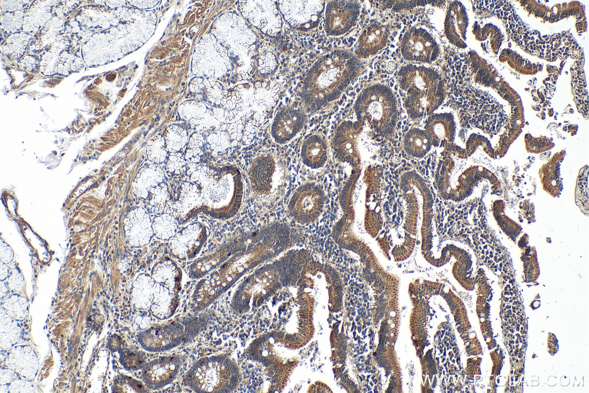 Immunohistochemistry (IHC) staining of human stomach tissue using SLC44A5 Polyclonal antibody (21117-1-AP)