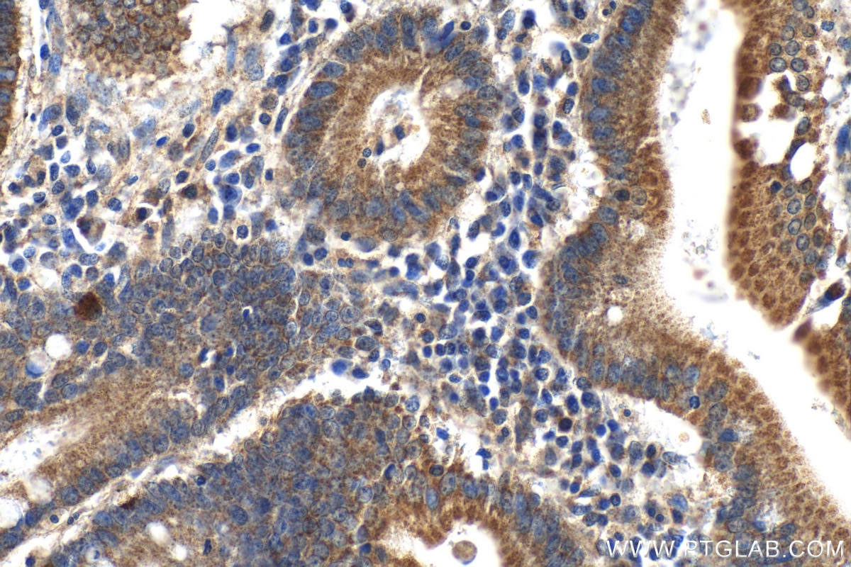 Immunohistochemistry (IHC) staining of human stomach tissue using SLC44A5 Polyclonal antibody (21117-1-AP)