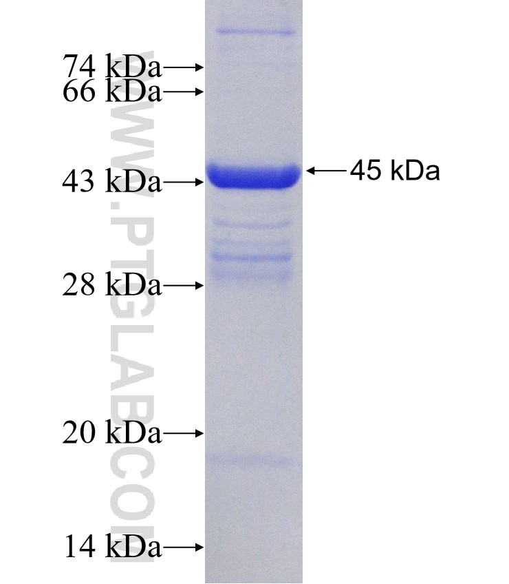 SLC44A5 fusion protein Ag15459 SDS-PAGE
