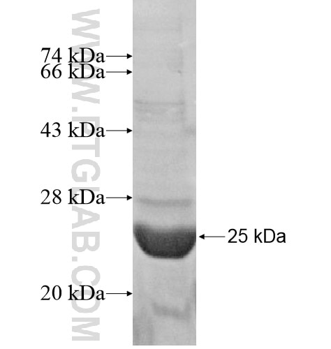SLC44A5 fusion protein Ag15549 SDS-PAGE