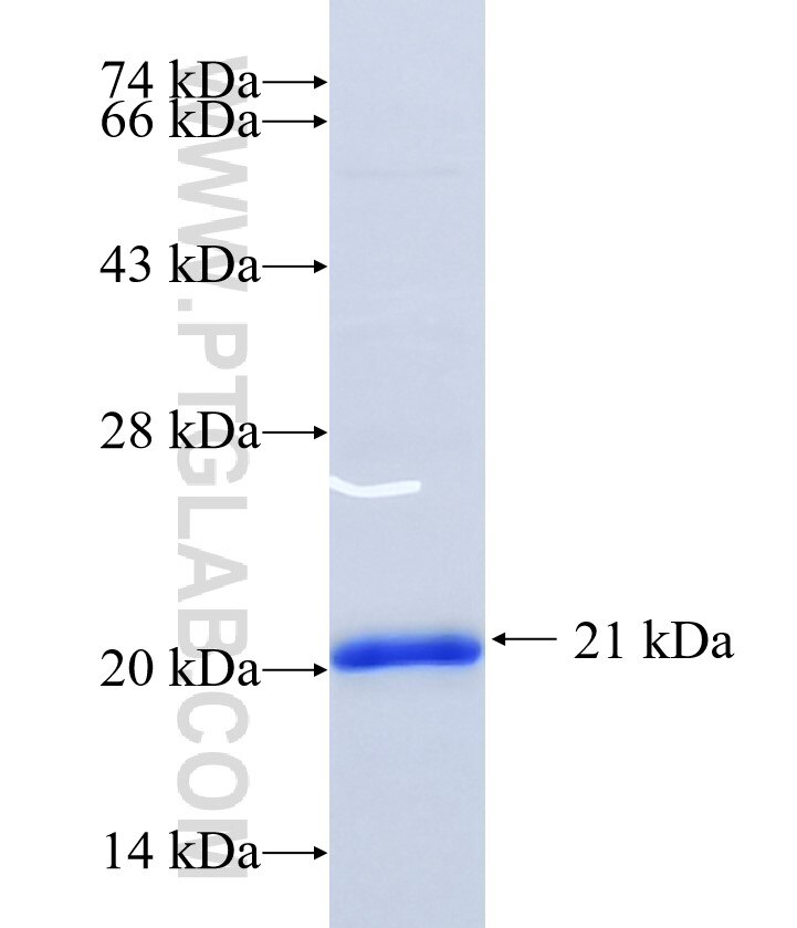 SLC45A1 fusion protein Ag34540 SDS-PAGE SLC45A1 fusion protein Ag34540 SDS-PAGE