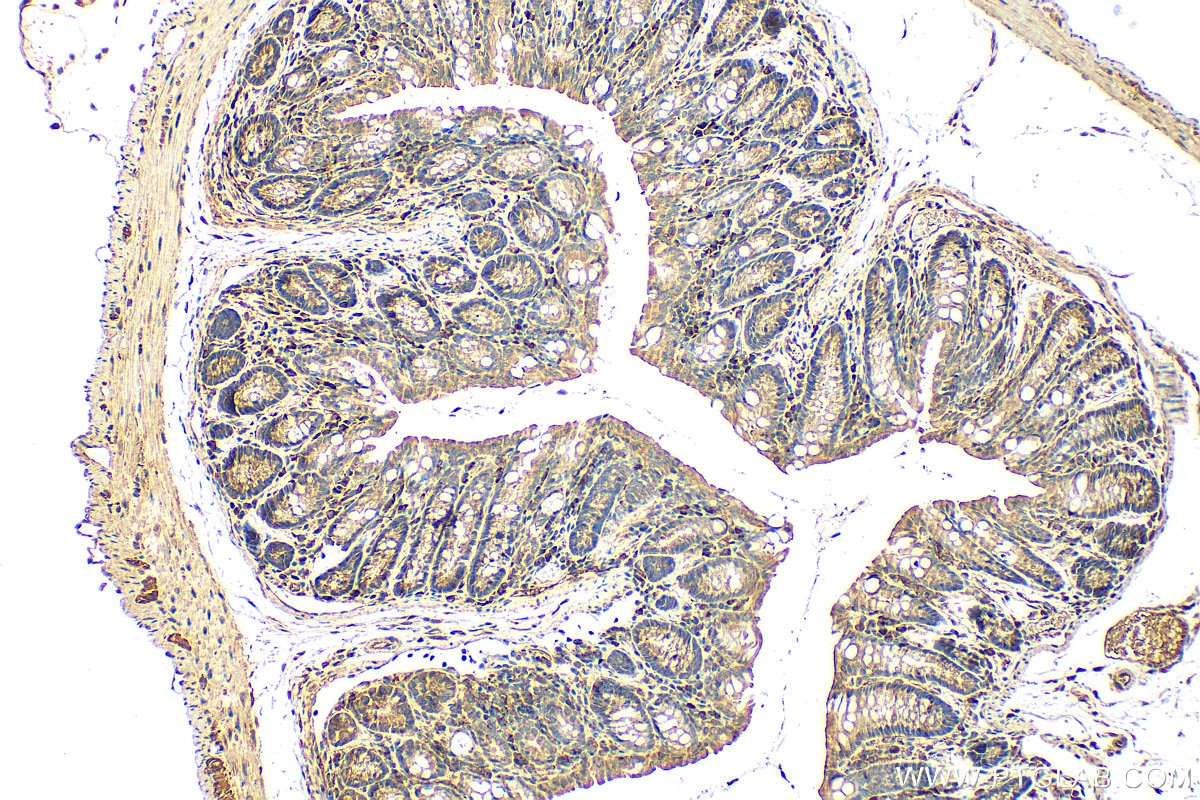 Immunohistochemistry (IHC) staining of mouse colon tissue using SLC45A2 Polyclonal antibody (10453-1-AP)
