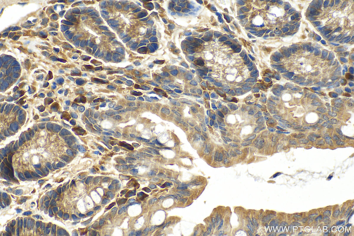 Immunohistochemistry (IHC) staining of mouse colon tissue using SLC45A2 Polyclonal antibody (10453-1-AP)