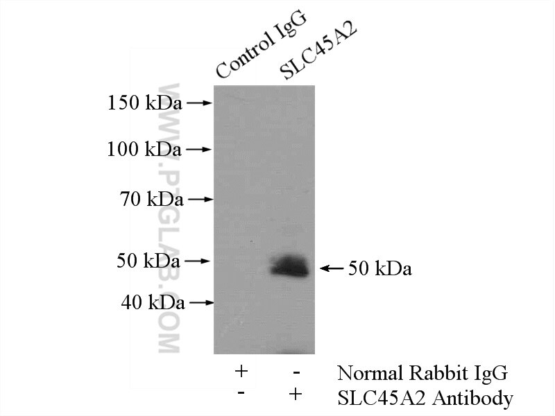 SLC45A2