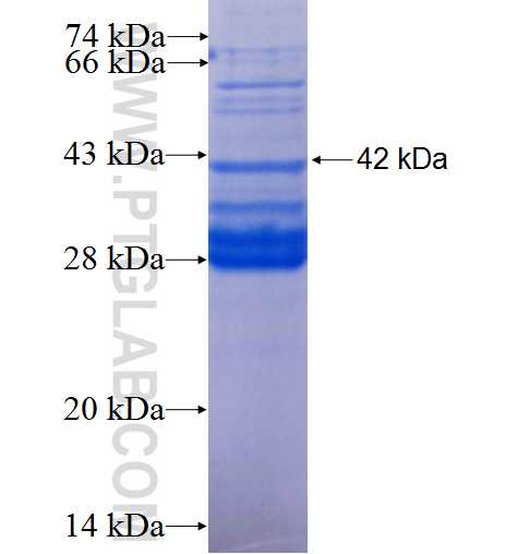 SLC45A2 fusion protein Ag0699 SDS-PAGE