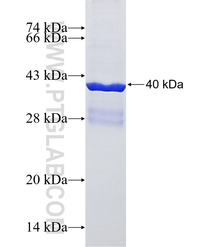 SLC45A2 fusion protein Ag0699 SDS-PAGE