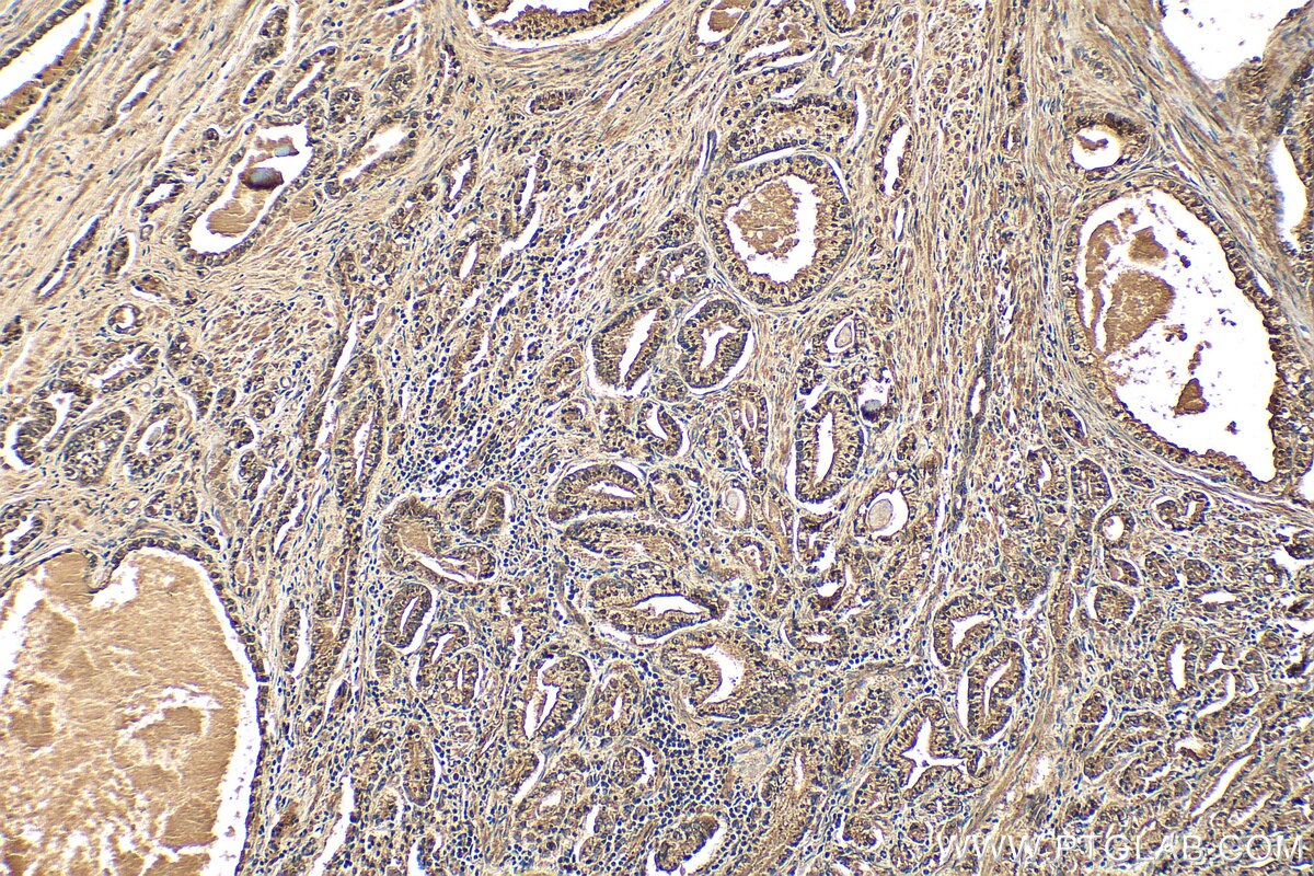 Immunohistochemistry (IHC) staining of human prostate hyperplasia tissue using Prostein Polyclonal antibody (14224-1-AP)