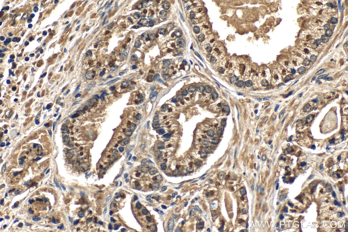 Immunohistochemistry (IHC) staining of human prostate hyperplasia tissue using Prostein Polyclonal antibody (14224-1-AP)