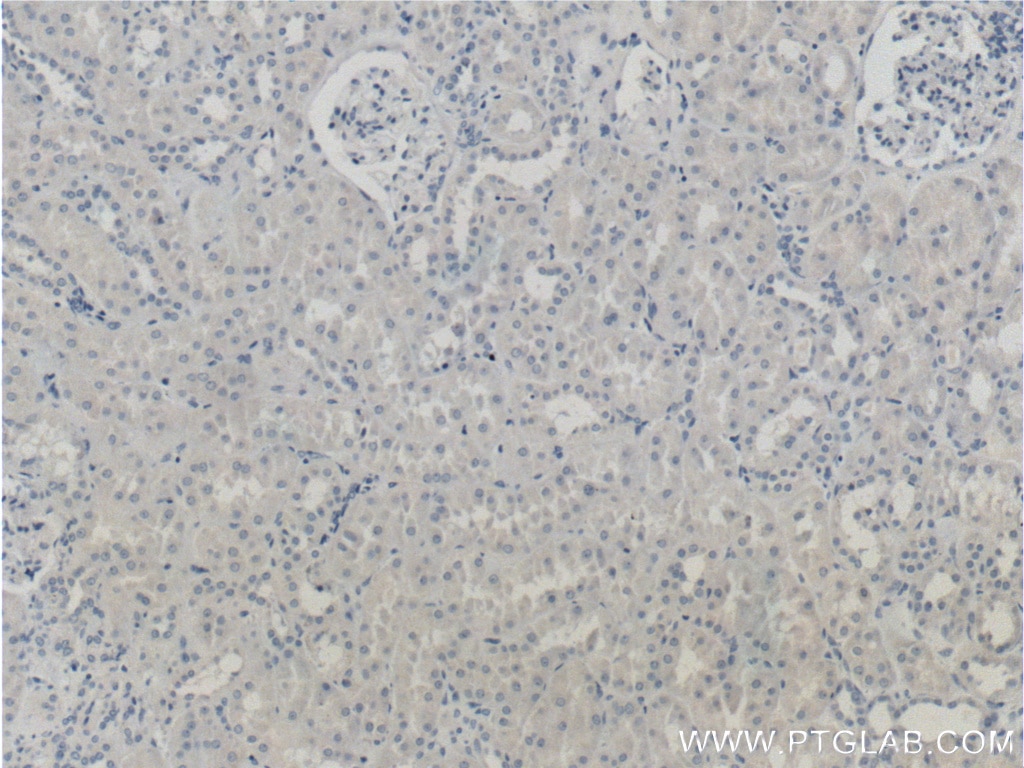 Immunohistochemistry (IHC) staining of human kidney tissue using Prostein Monoclonal antibody (60343-1-Ig)