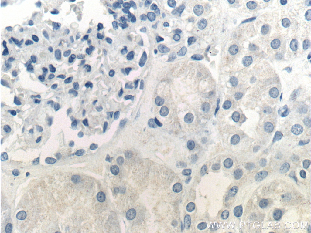 Immunohistochemistry (IHC) staining of human kidney tissue using Prostein Monoclonal antibody (60343-1-Ig)