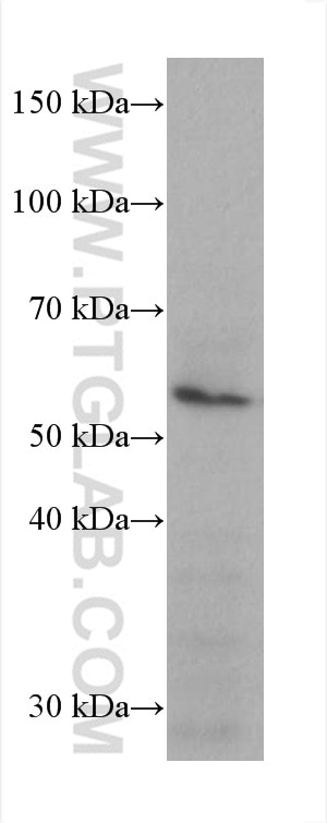 Western Blot (WB) analysis of JAR cells using Prostein Monoclonal antibody (60343-1-Ig)