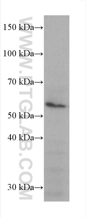 WB analysis of JAR using 60343-1-Ig