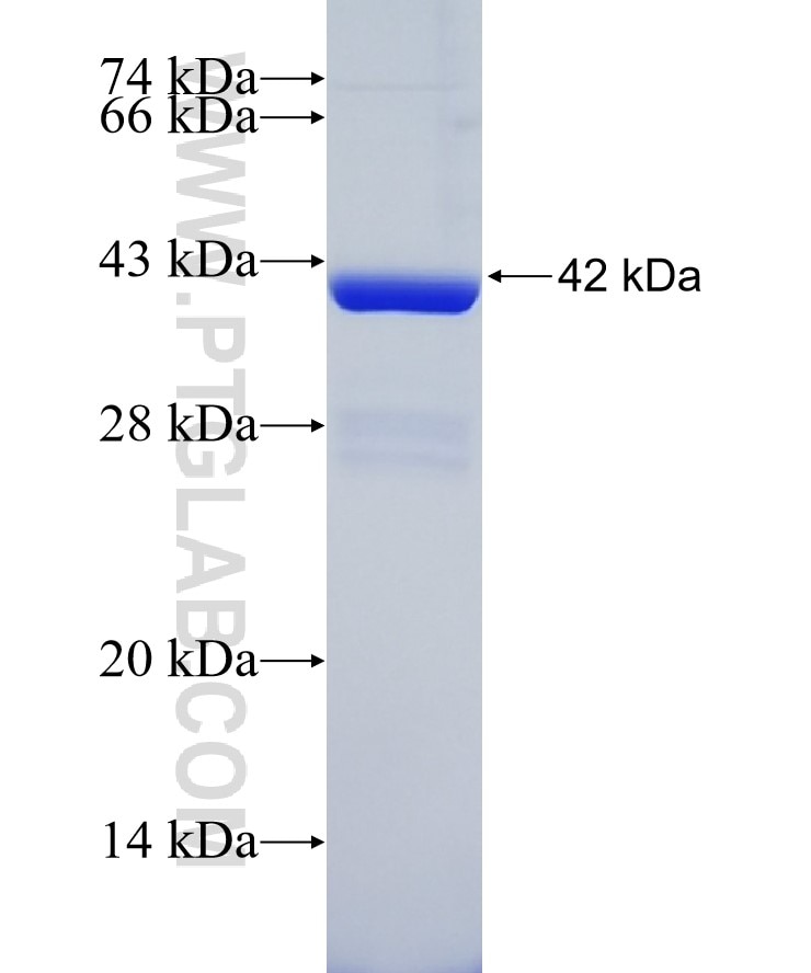 SLC45A3 fusion protein Ag5463 SDS-PAGE