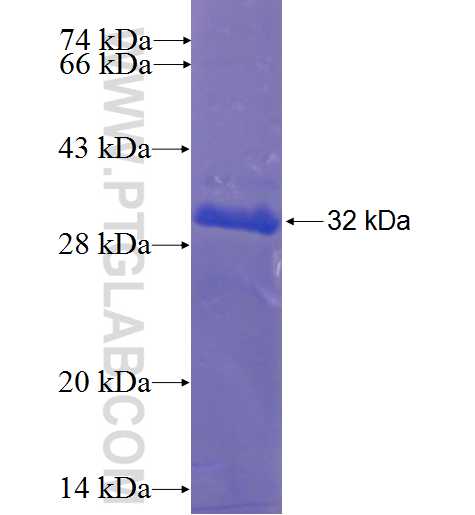 SLC46A2 fusion protein Ag5707 SDS-PAGE