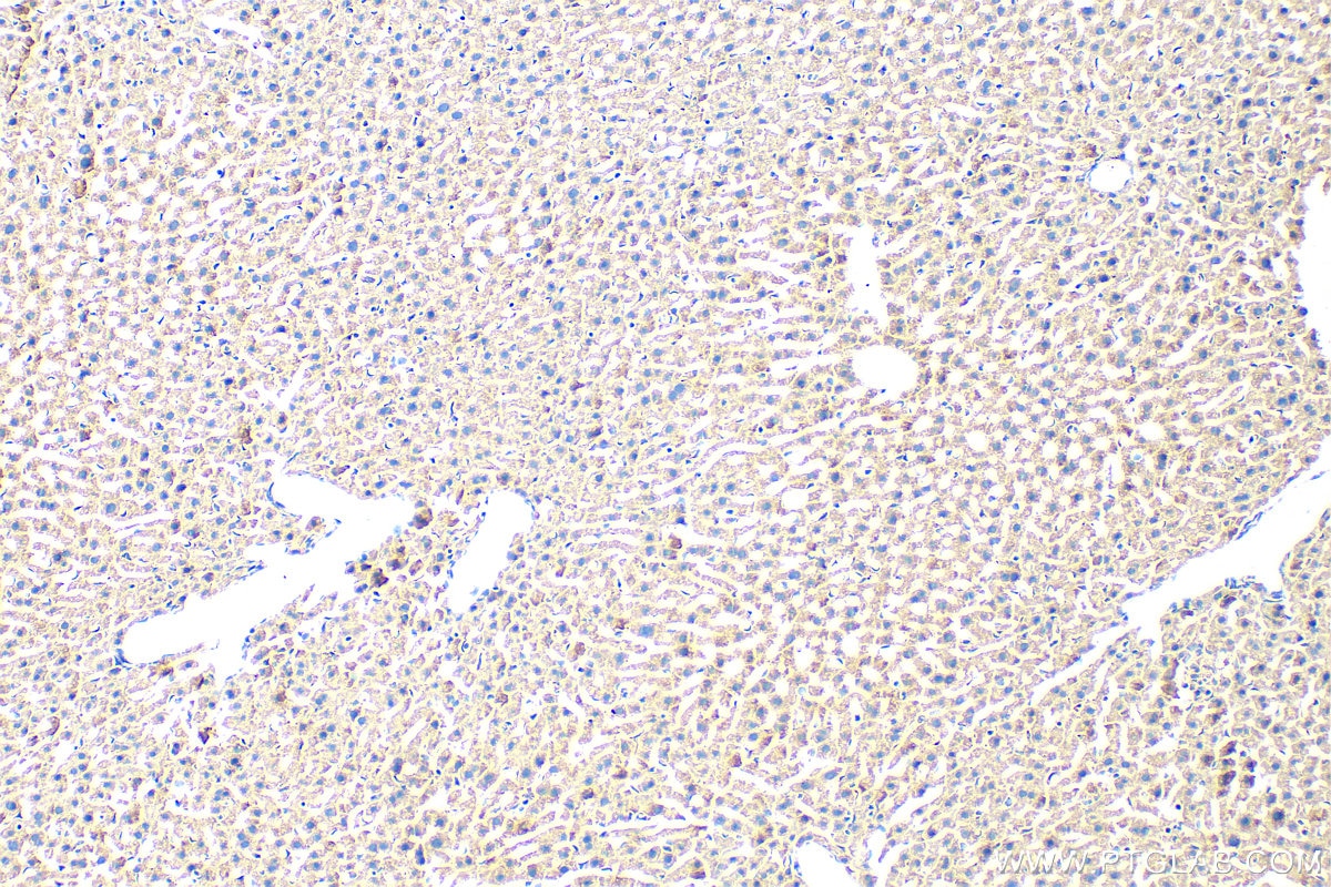 IHC staining of mouse liver using 31031-1-AP