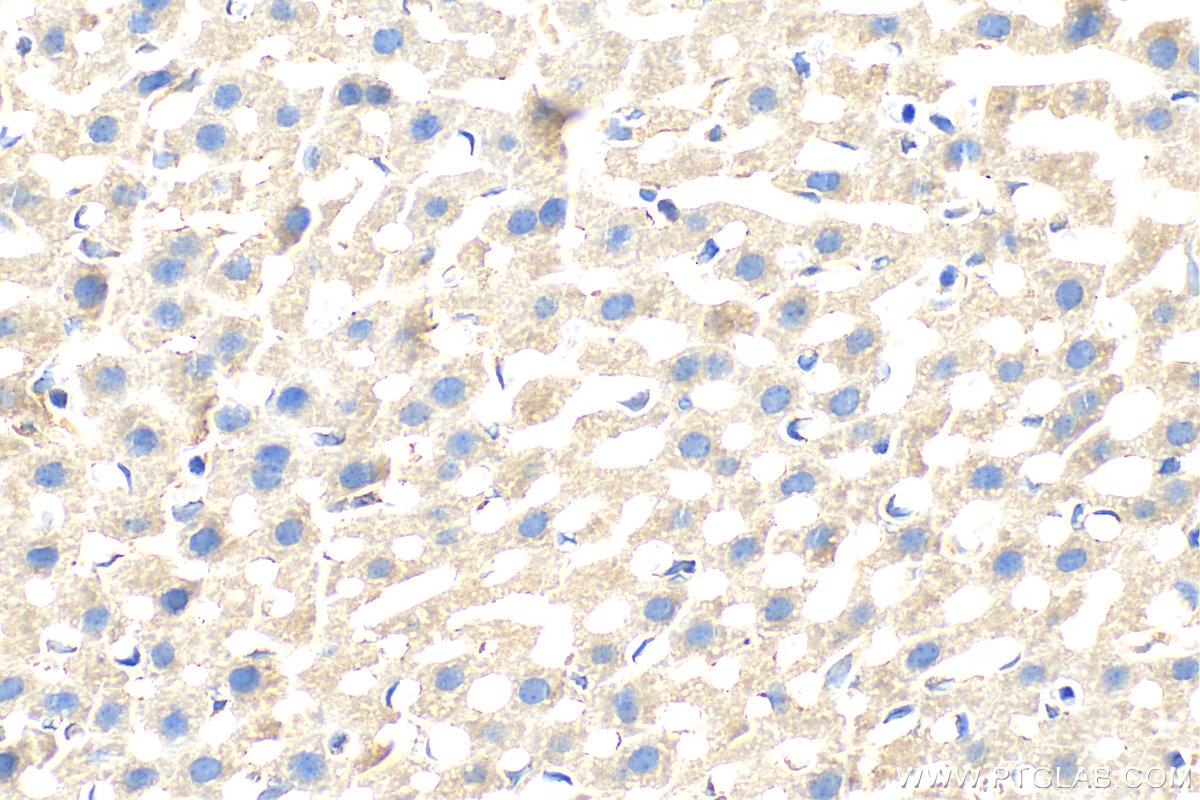 Immunohistochemistry (IHC) staining of mouse liver tissue using SLC46A3 Polyclonal antibody (31031-1-AP)