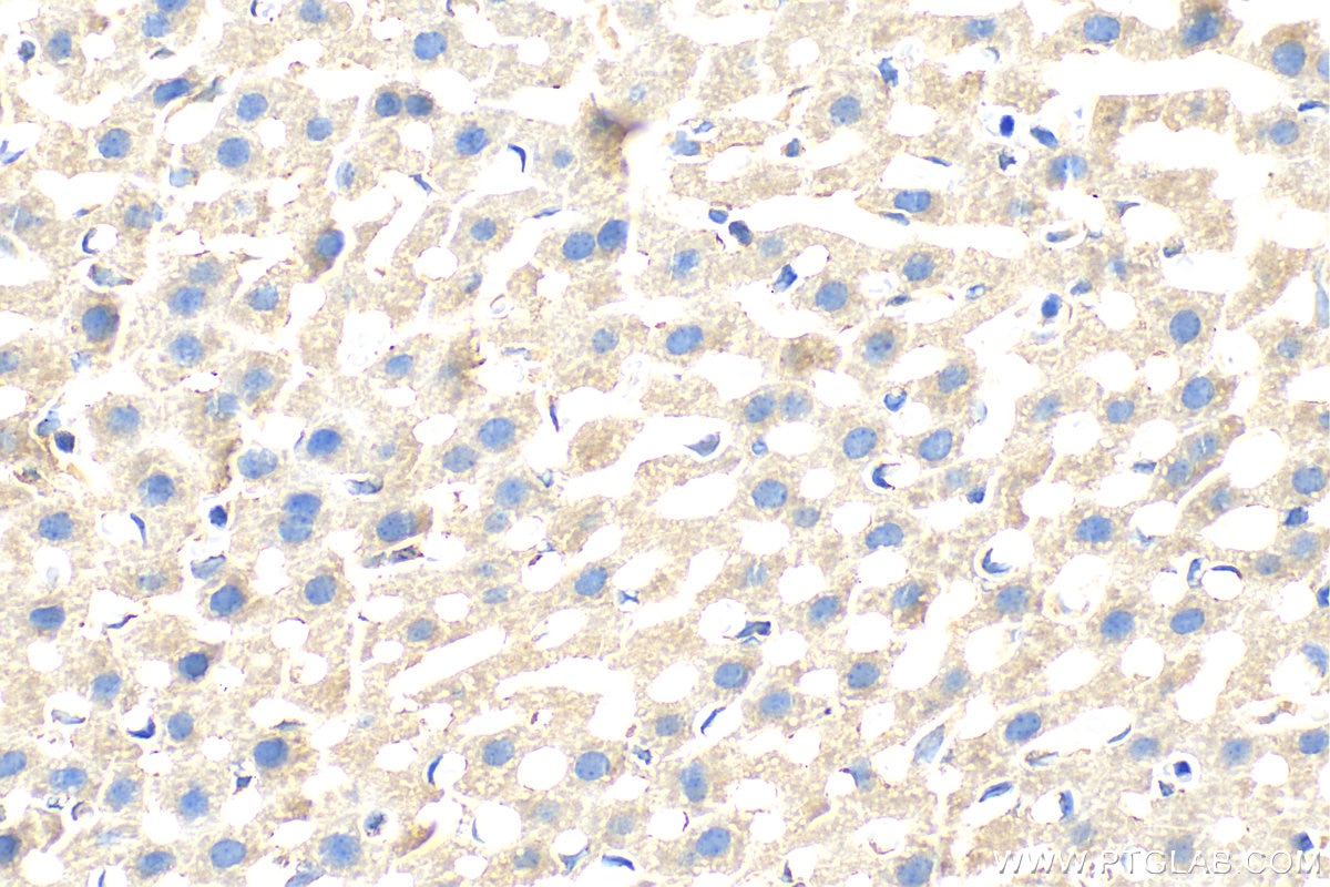 IHC staining of mouse liver using 31031-1-AP