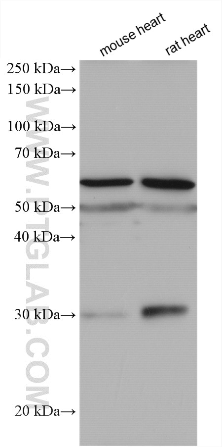 Western Blot (WB) analysis of various lysates using SLC47A1 Polyclonal antibody (20898-1-AP)
