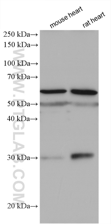 Western Blot (WB) analysis of various lysates using SLC47A1 Polyclonal antibody (20898-1-AP)