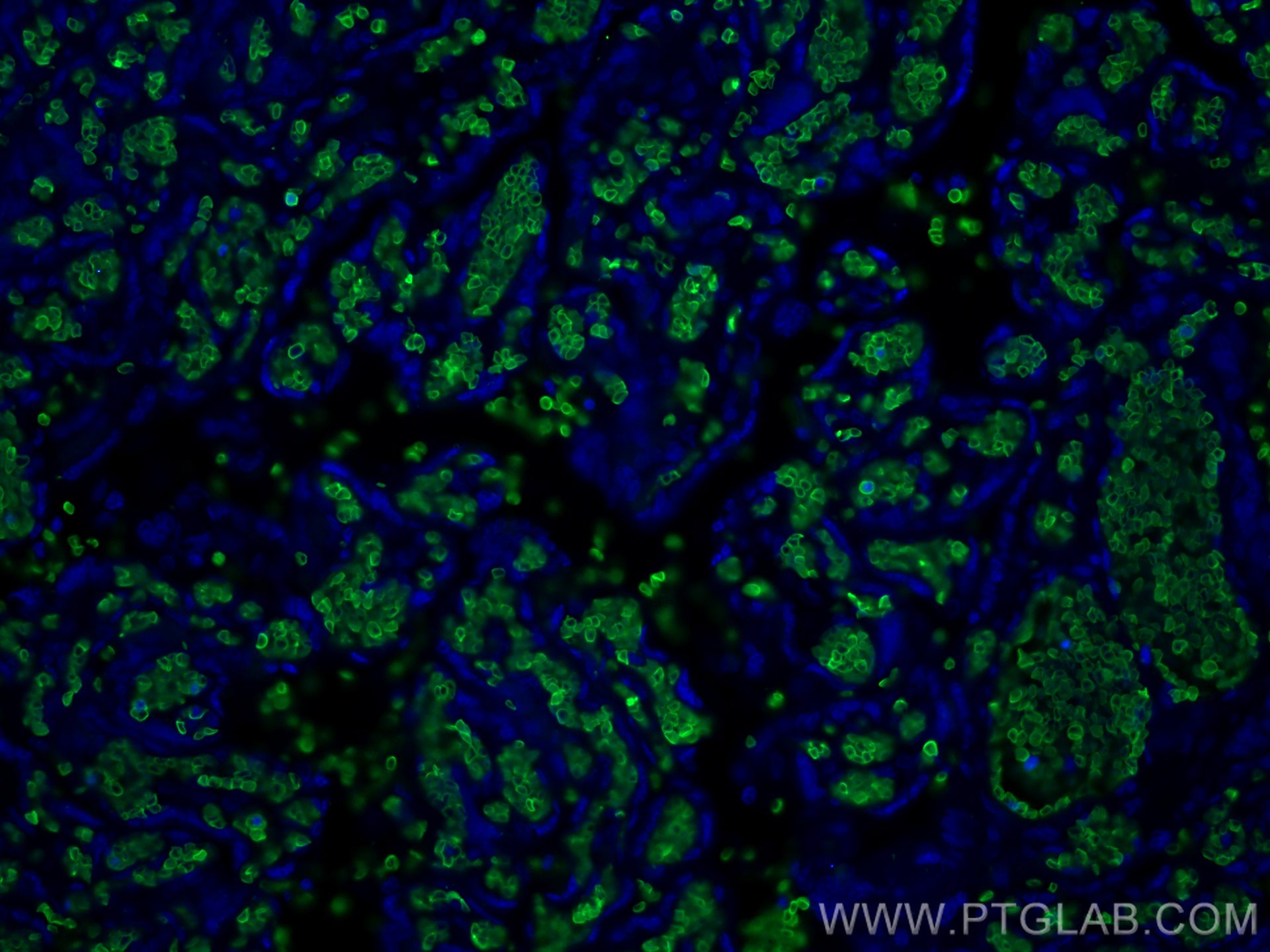 Immunofluorescence (IF) / fluorescent staining of human placenta tissue using Band 3/ AE1 Polyclonal antibody (18566-1-AP)