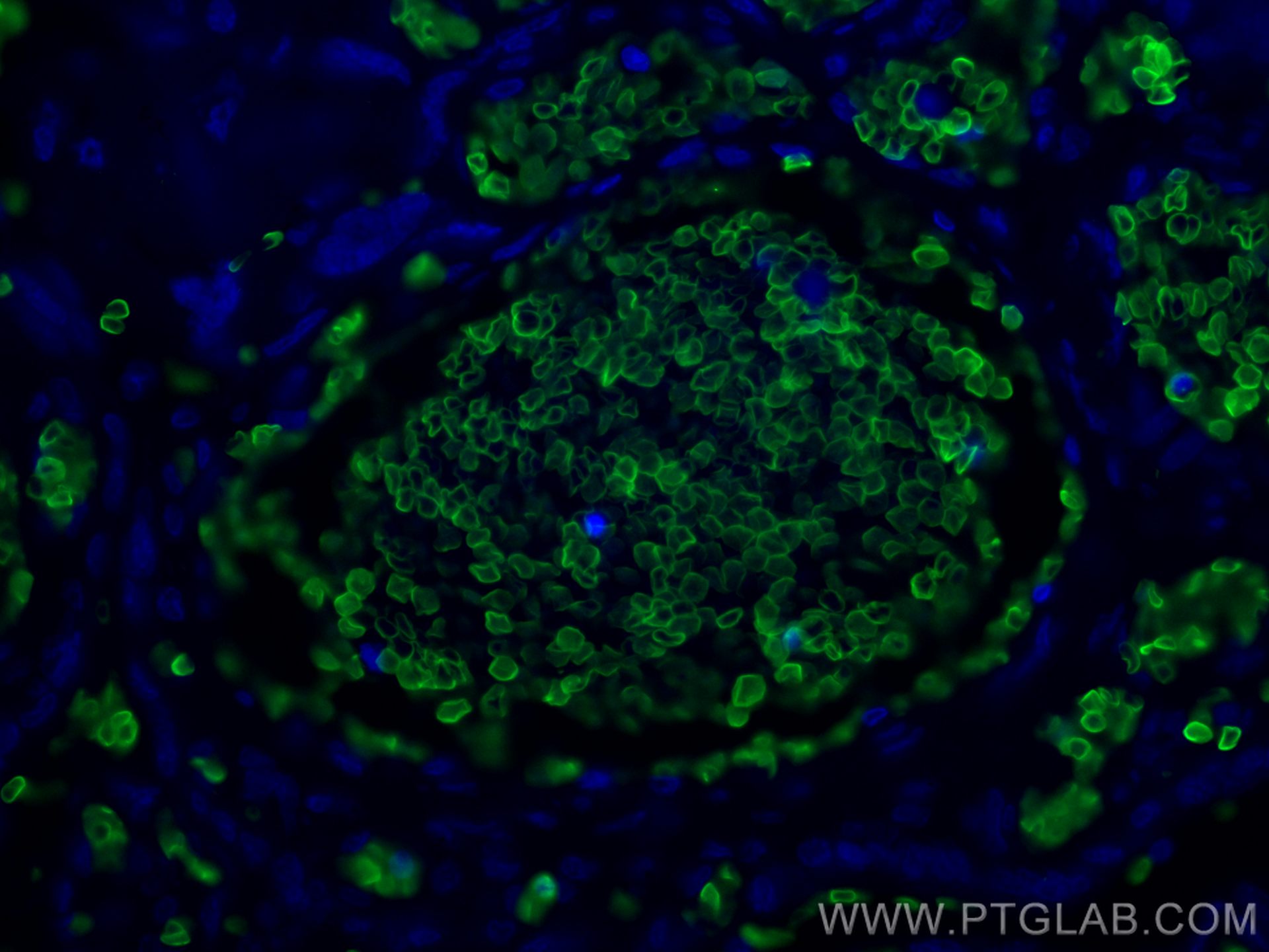 Immunofluorescence (IF) / fluorescent staining of human placenta tissue using Band 3/ AE1 Polyclonal antibody (18566-1-AP)