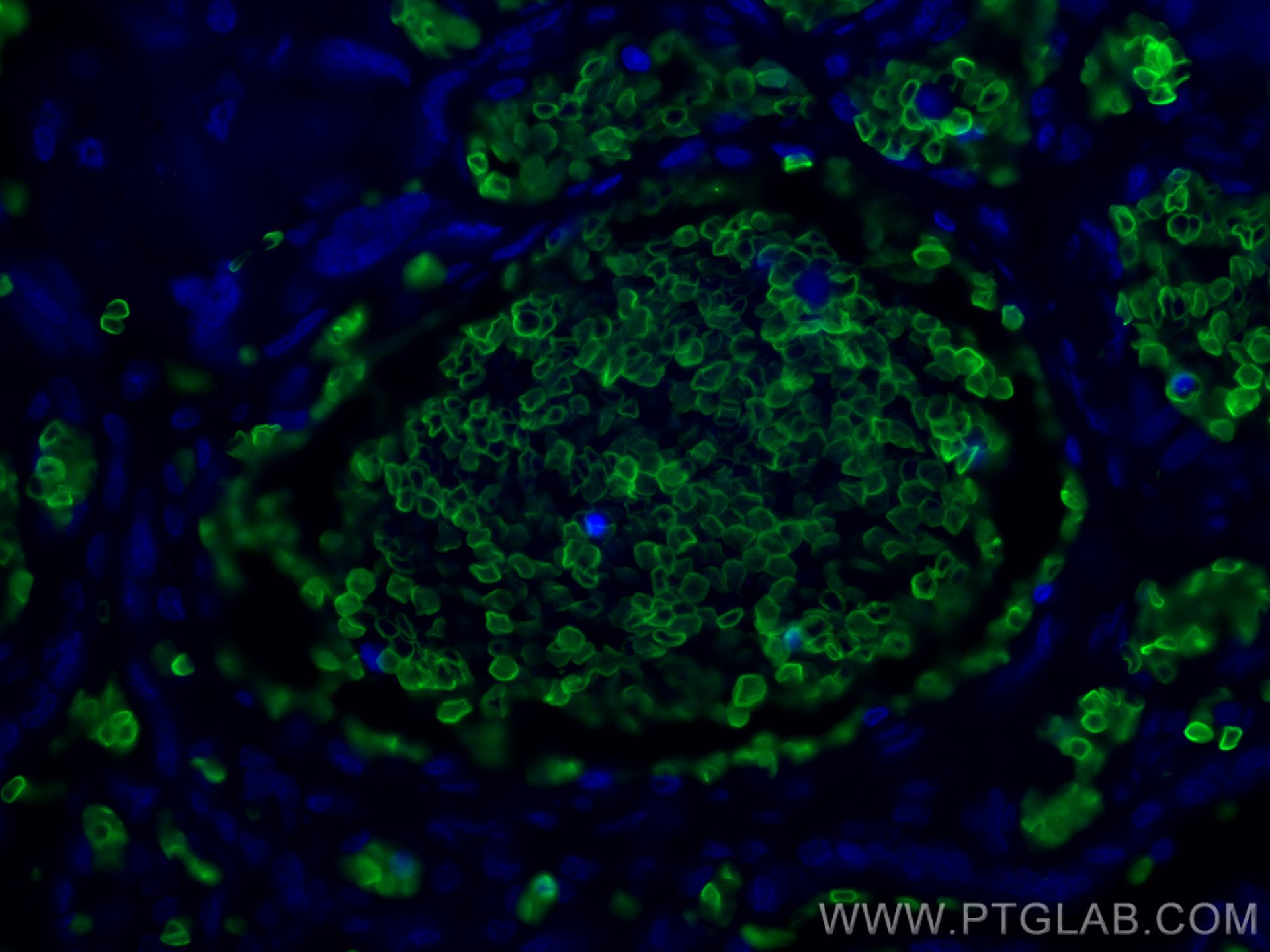 Immunofluorescence (IF) / fluorescent staining of human placenta tissue using Band 3/AE 1 Polyclonal antibody (18566-1-AP)