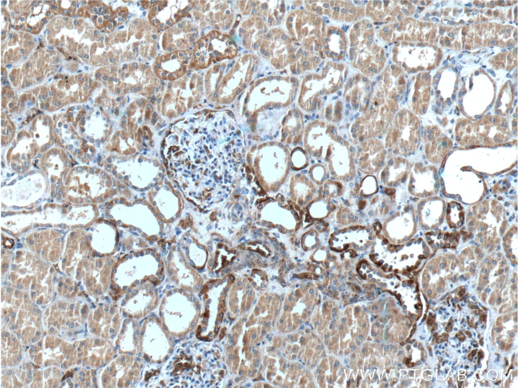 Immunohistochemistry (IHC) staining of human kidney tissue using Band 3/ AE1 Polyclonal antibody (18566-1-AP)