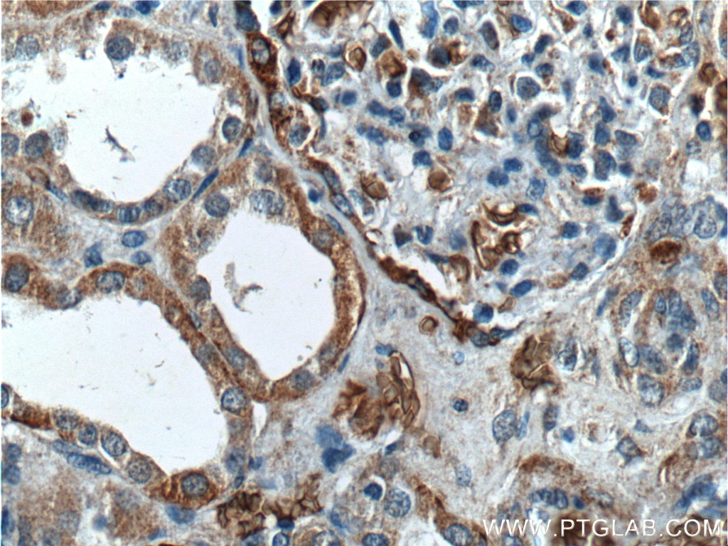 IHC staining of human kidney using 18566-1-AP