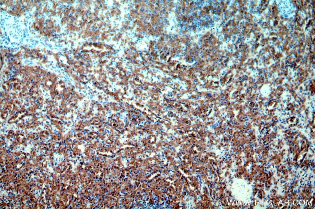Immunohistochemistry (IHC) staining of human spleen tissue using Band 3/ AE1 Polyclonal antibody (18566-1-AP)
