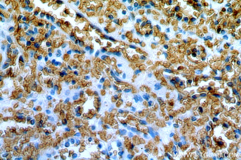 Immunohistochemistry (IHC) staining of human spleen tissue using Band 3/ AE1 Polyclonal antibody (18566-1-AP)