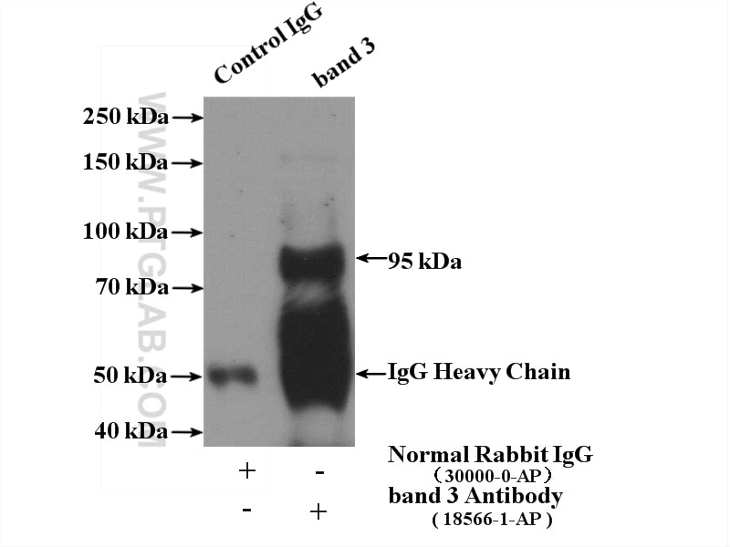 Immunoprecipitation (IP) experiment of mouse liver tissue using Band 3/ AE1 Polyclonal antibody (18566-1-AP)