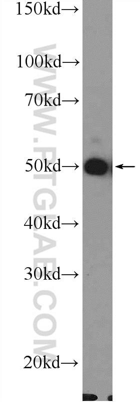 Western Blot (WB) analysis of HepG2 cells using Band 3/ AE1 Polyclonal antibody (18566-1-AP)