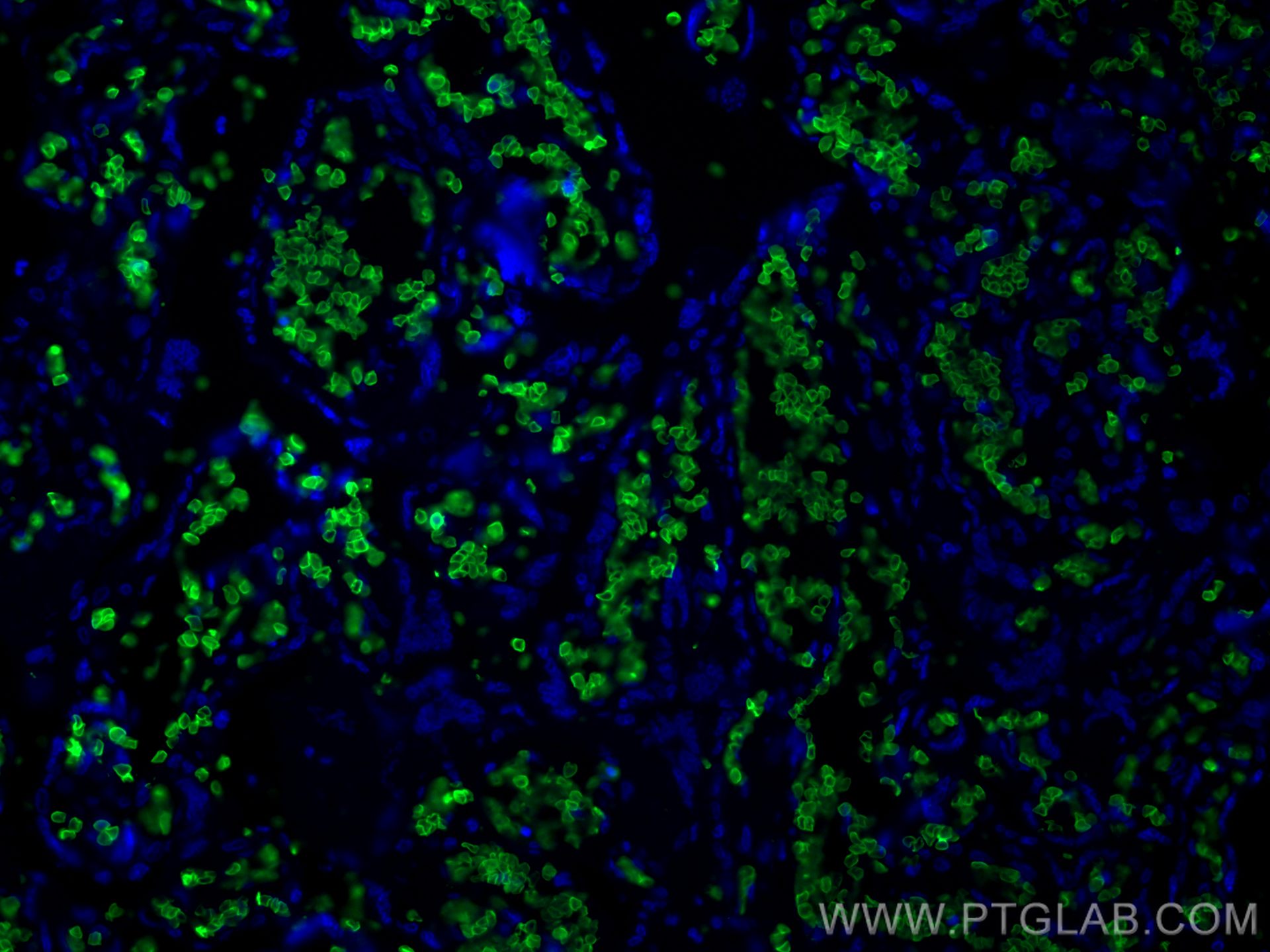 Immunofluorescence (IF) / fluorescent staining of human placenta tissue using Band 3/ AE1 Polyclonal antibody (28131-1-AP)