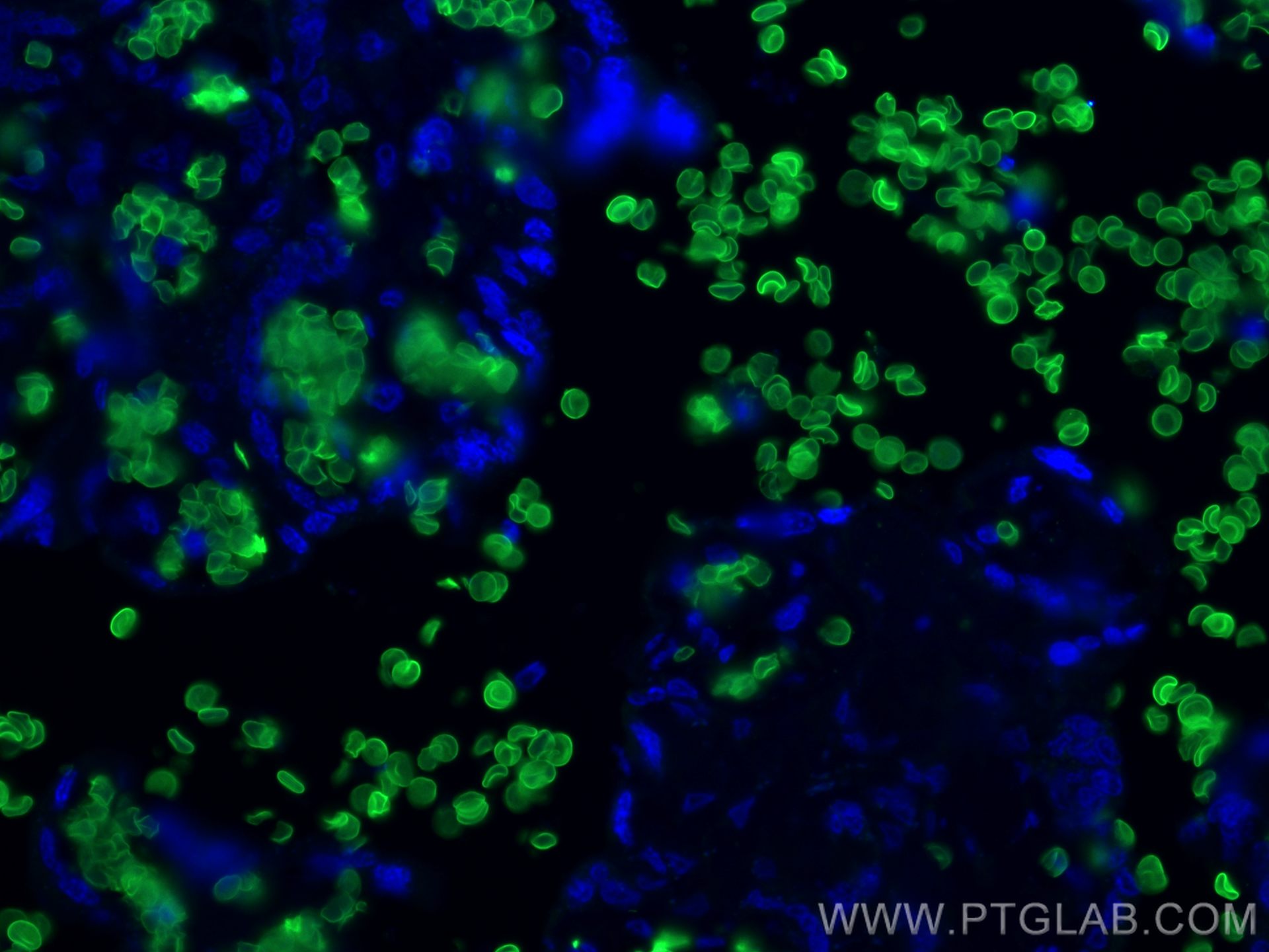 Band 3/ AE1 antibody (28131-1-AP)