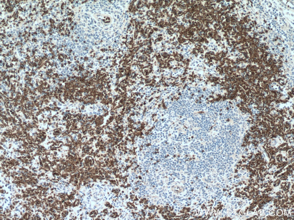 Immunohistochemistry (IHC) staining of human spleen tissue using Band 3/ AE1 Polyclonal antibody (28131-1-AP)