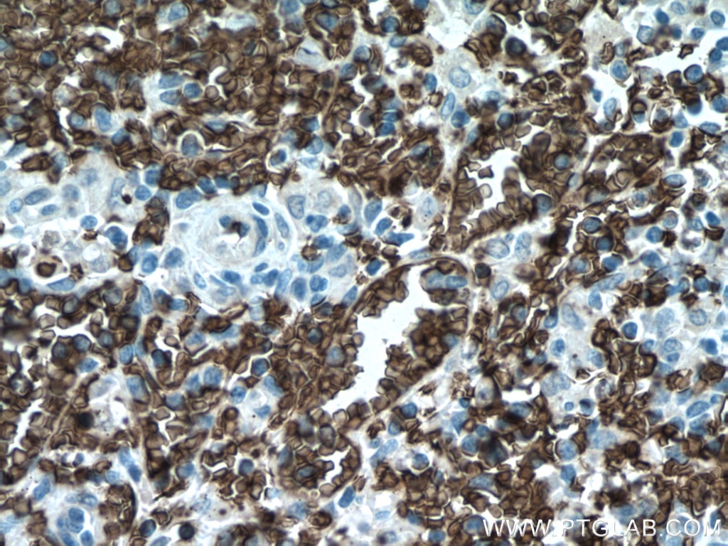 Immunohistochemistry (IHC) staining of human spleen tissue using Band 3/ AE1 Polyclonal antibody (28131-1-AP)
