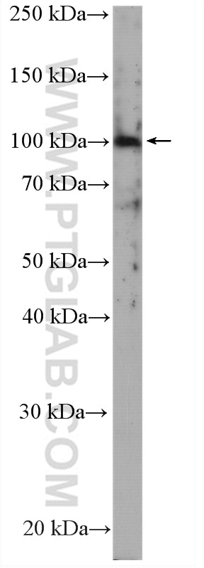 Western Blot (WB) analysis of mouse liver tissue using Band 3/ AE1 Polyclonal antibody (28131-1-AP)