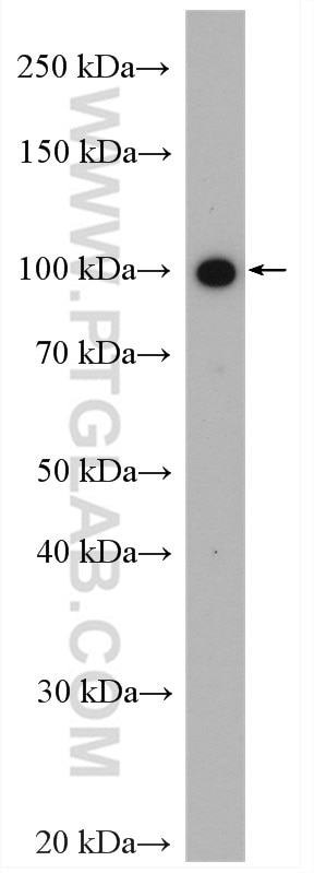 Western Blot (WB) analysis of COLO 320 cells using Band 3/ AE1 Polyclonal antibody (28131-1-AP)