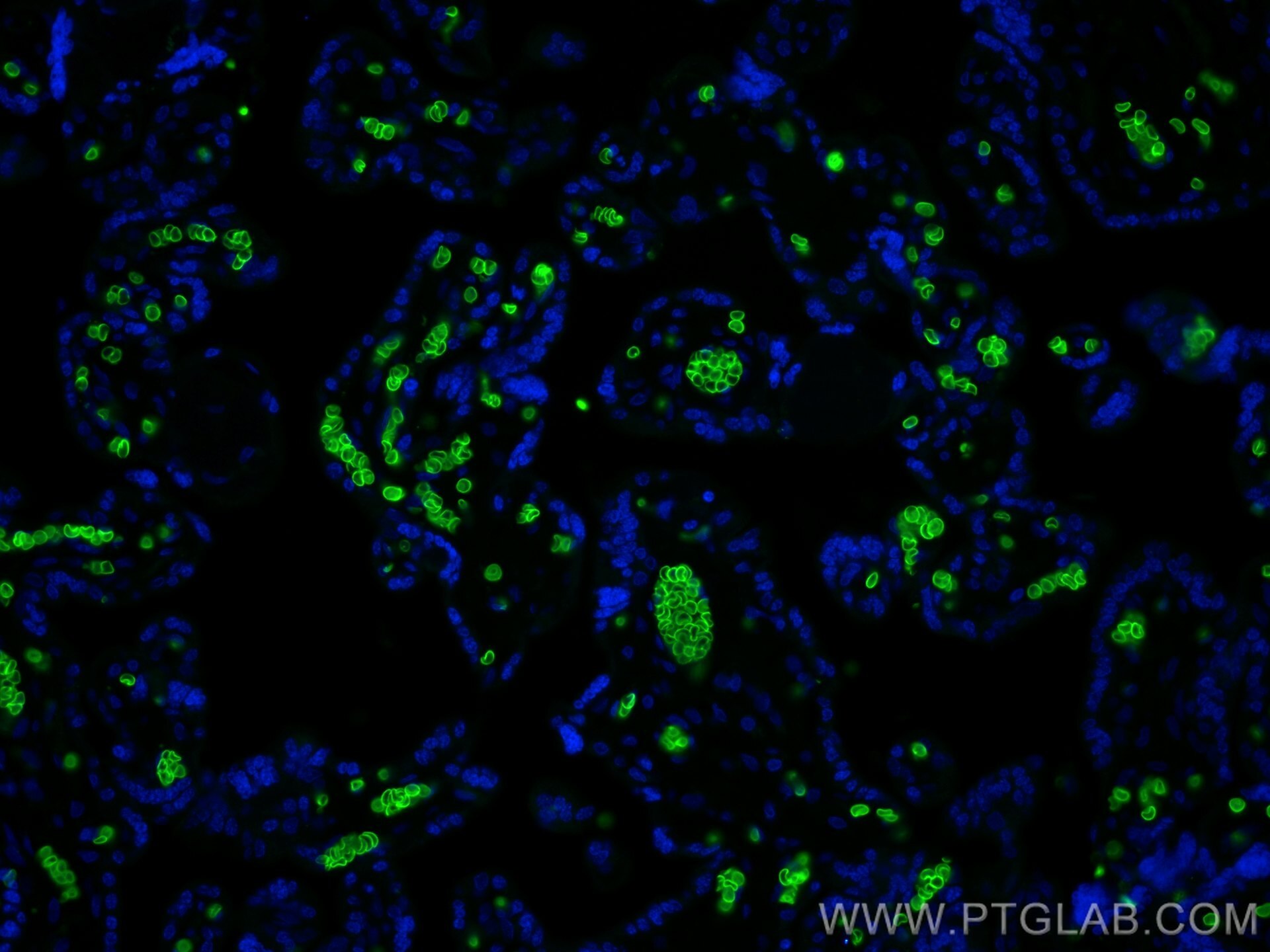 IF Staining of human placenta using 81066-1-RR