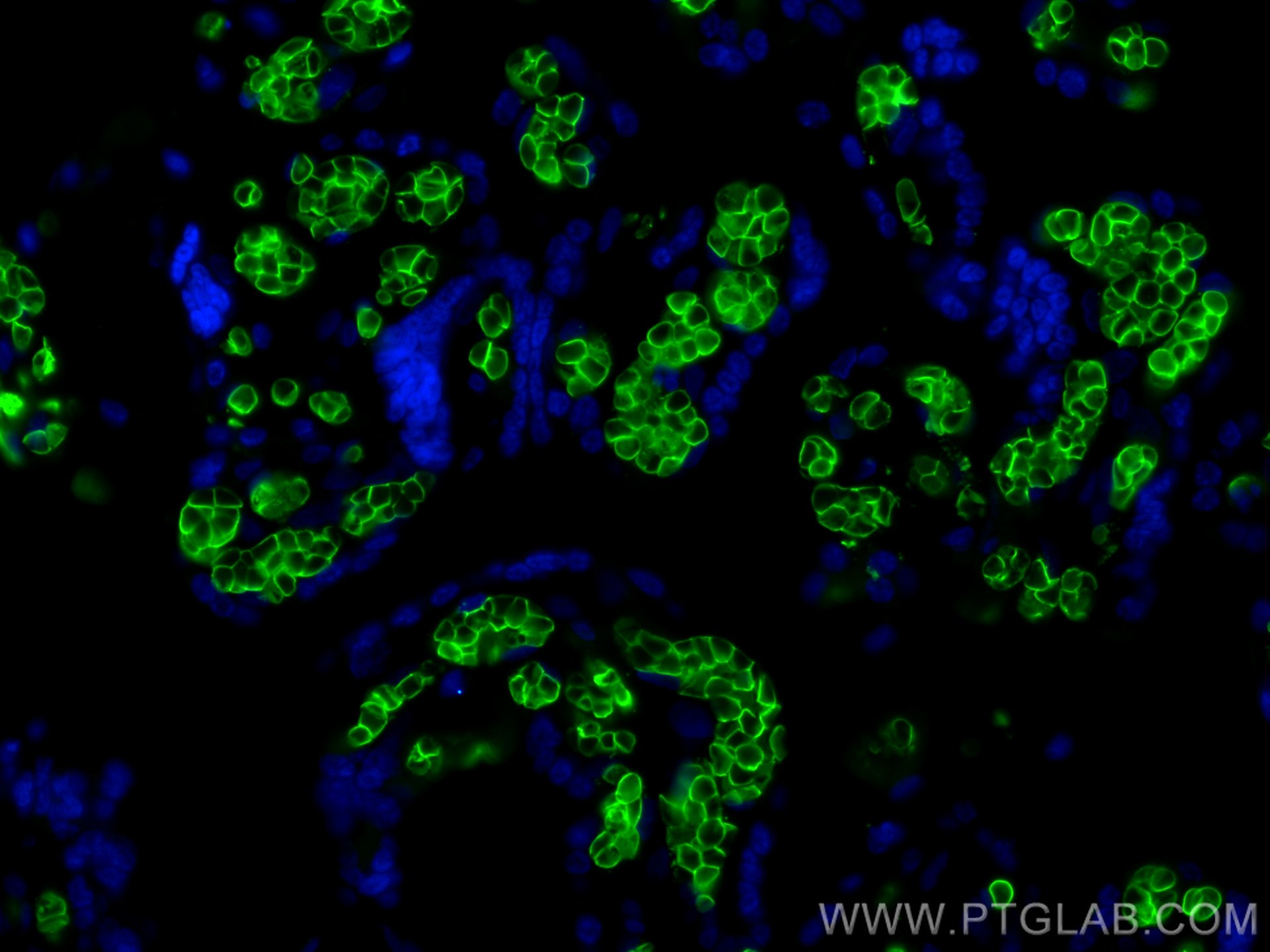 Immunofluorescence (IF) / fluorescent staining of human placenta tissue using Band 3/ AE1 Recombinant antibody (81066-1-RR)