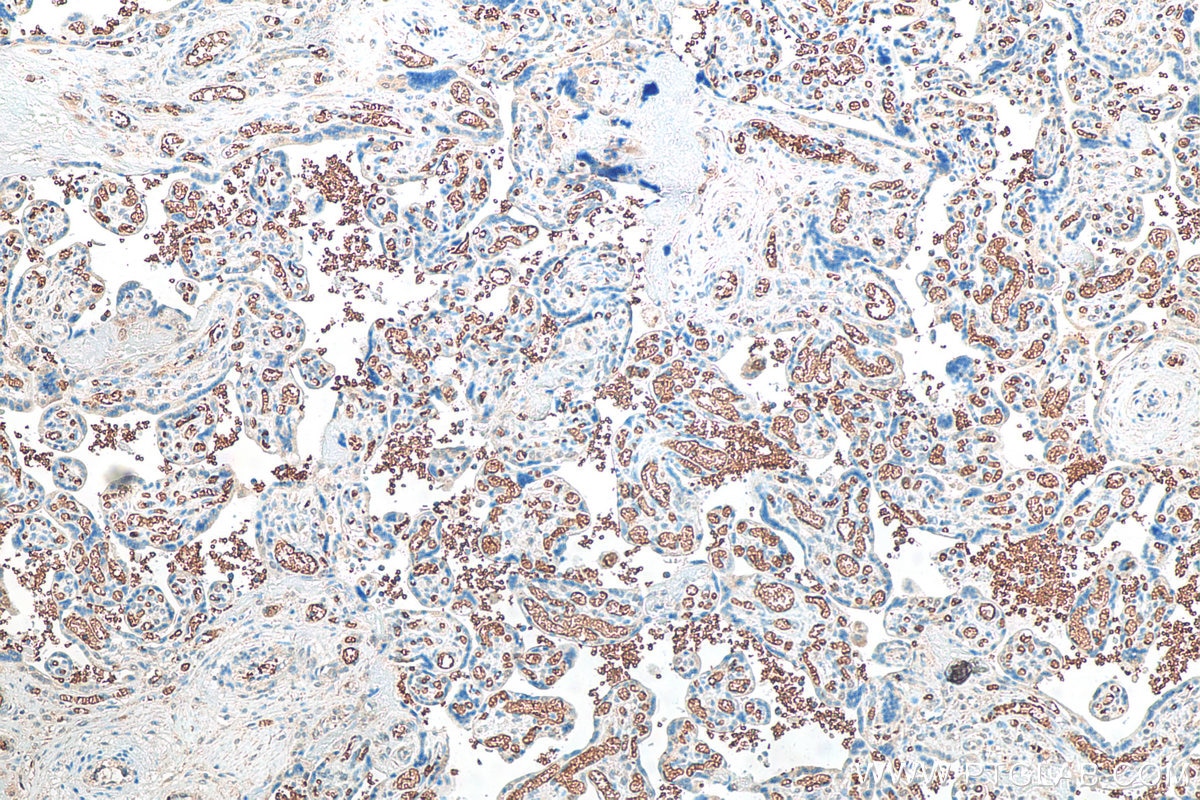 Immunohistochemistry (IHC) staining of human placenta tissue using Band 3/ AE1 Recombinant antibody (81066-1-RR)