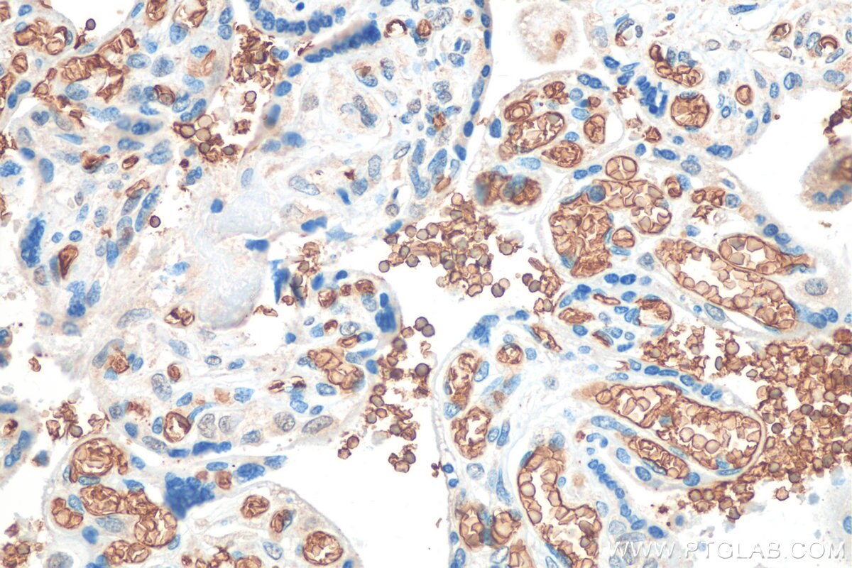 Immunohistochemistry (IHC) staining of human placenta tissue using Band 3/ AE1 Recombinant antibody (81066-1-RR)