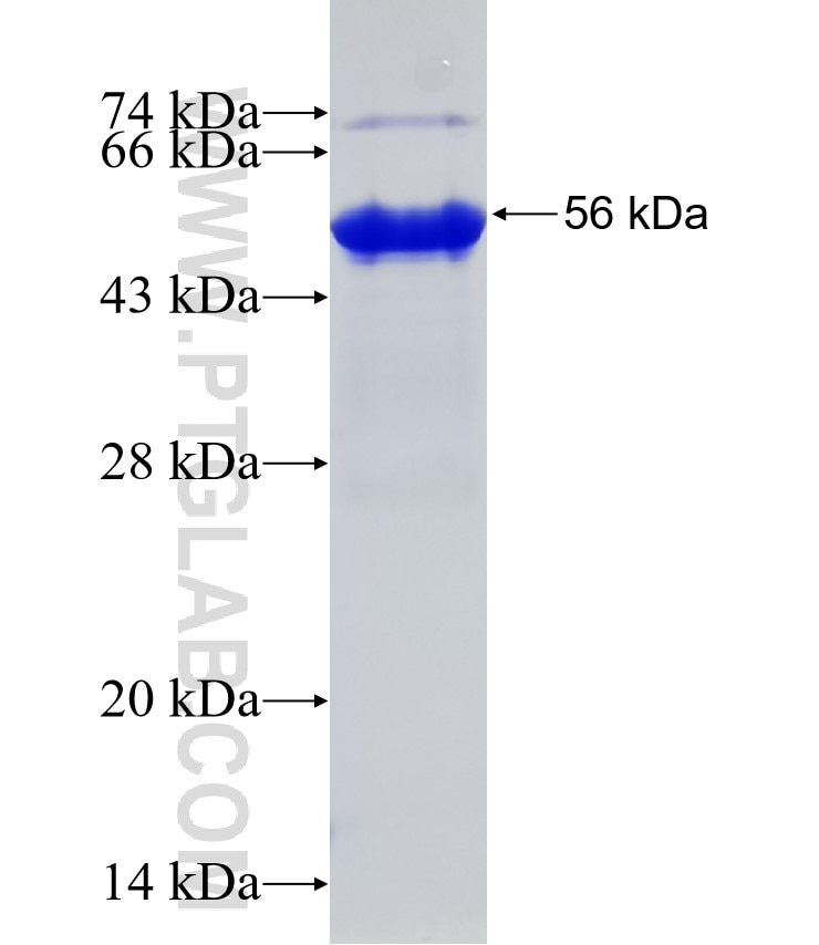 SLC4A1 fusion protein Ag27878 SDS-PAGE
