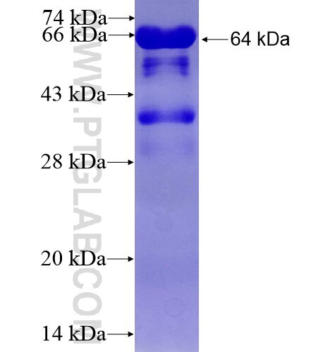 SLC4A1 fusion protein Ag13076 SDS-PAGE